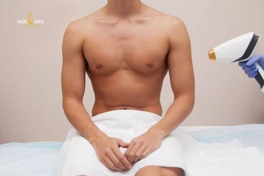 Triệt lông vùng kín nam hỗ trợ làm giảm mùi hôi ở vùng nhạy cảm