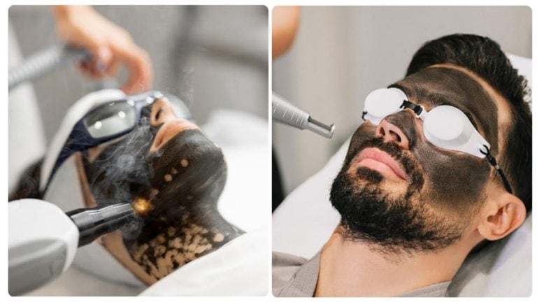 Triệt râu vĩnh viễn: Hiệu quả và lựa chọn an toàn