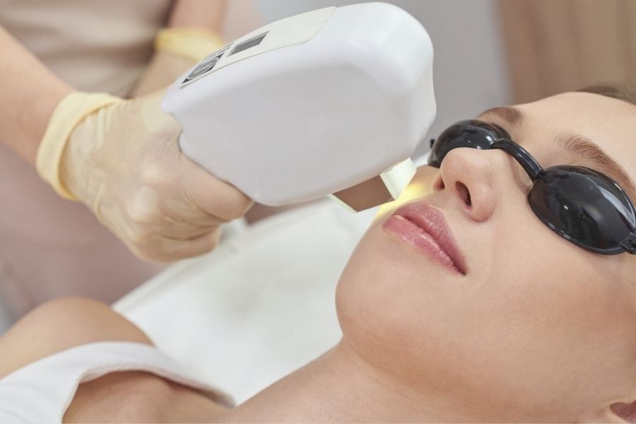 Triệt ria mép có ảnh hưởng gì không? Cách triệt vĩnh viễn 12 Ngọc Dung có quy trình triệt ria mép chuyên nghiệp