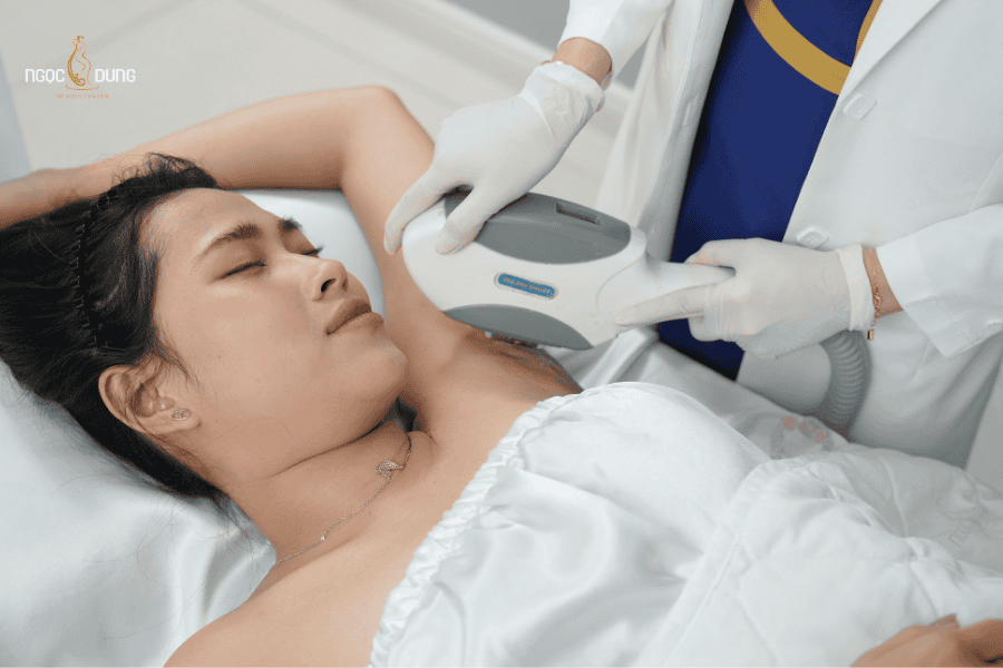 Tùy công nghệ sử dụng trị thâm nách sẽ có mức giá khác nhau 