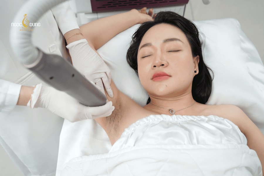 Ưu điểm vượt trội khi sử dụng dịch vụ trị thâm nách tại Ngọc Dung