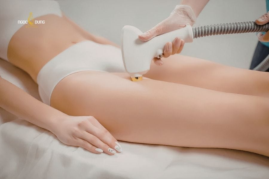Nhiều người lo lắng triệt lông có ảnh hưởng đến sinh sản không do thiếu thông tin y khoa chính thống