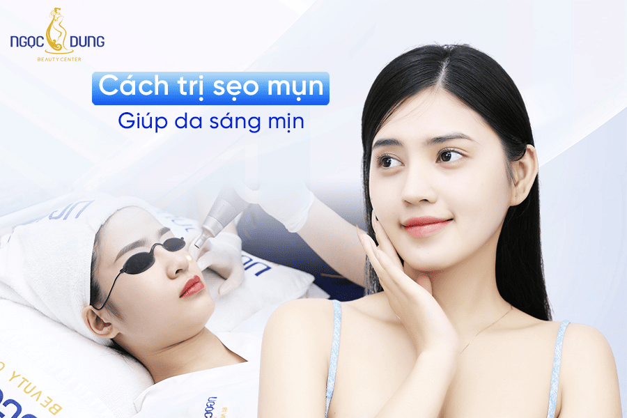 Cách trị sẹo mụn và phòng tránh sẹo sau mụn giúp da láng mịn 2 15+ Cách trị sẹo mụn hiệu quả, an toàn giúp da mịn màng, săn chắc