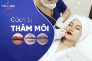 16 Cách trị thâm môi hiệu quả, hồng hào, căng mọng trở lại