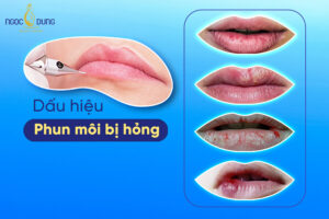 6 Dấu hiệu phun môi bị hỏng và cách khắc phục chuẩn y khoa