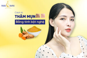 TOP 14 cách trị thâm mụn bằng tinh bột nghệ đơn giản