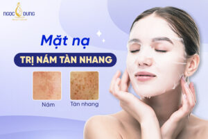 Cách làm mặt nạ trị nám tàn nhang hiệu quả ngay tại nhà