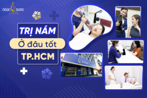 Trị nám ở đâu tốt TPHCM? Địa chỉ trị nám chất lượng nhất
