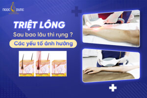 triệt lông sau bao lâu thì rụng
