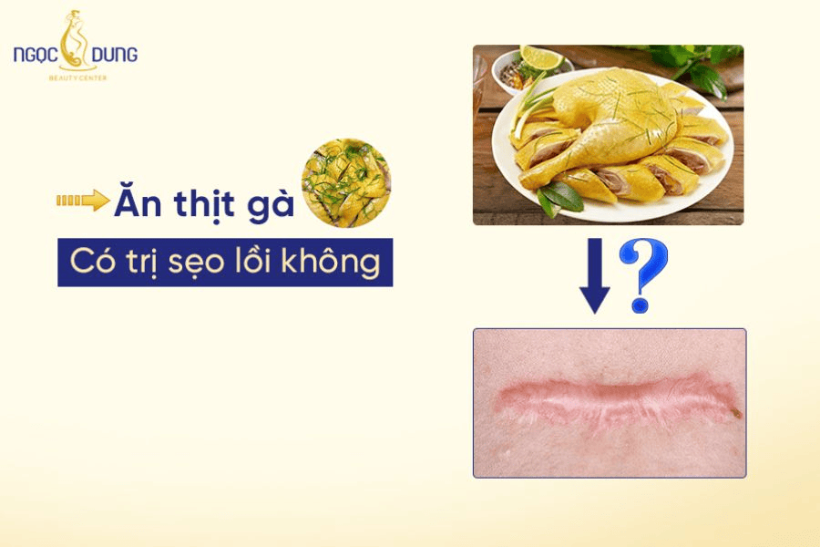 Ăn thịt gà có giúp trị sẹo lồi không? 
