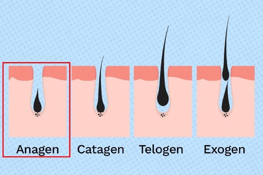 Anagen là giai đoạn quyết định phần lớn chiều dài và độ phát triển của sợi lông