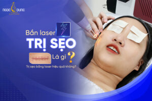 bắn laser trị sẹo