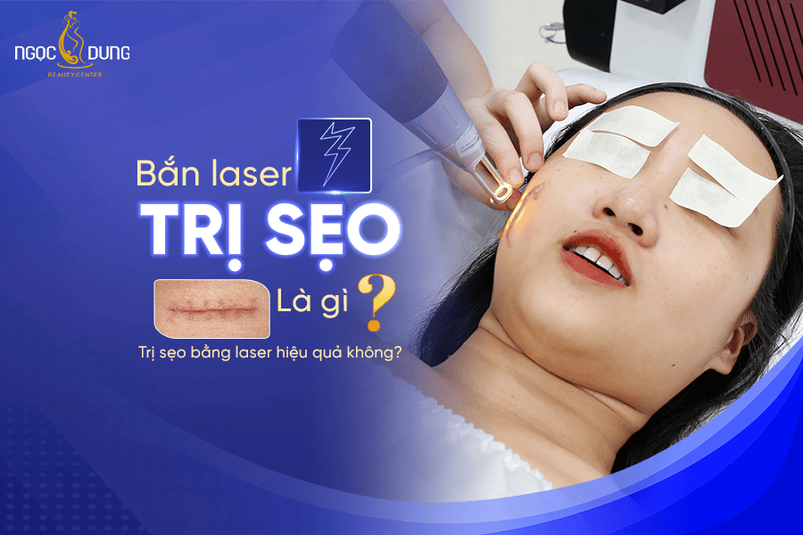 Bắn laser trị sẹo tại TMV Ngọc Dung