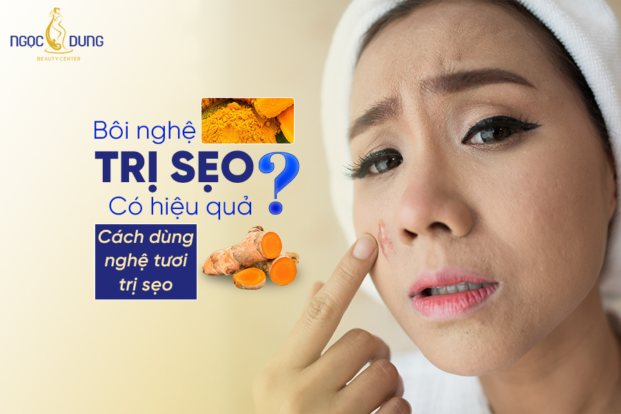 Bôi nghệ trị sẹo