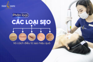 các loại sẹo