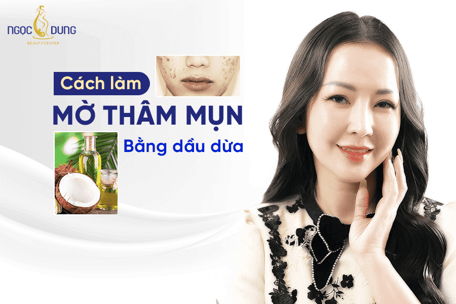 7 cách làm mờ vết thâm mụn bằng dầu dừa tại nhà hiệu quả 2 Cách làm mờ thâm mụn bằng dầu dừa giúp da sáng mịn