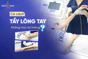 cách tẩy lông tay không mọc lại