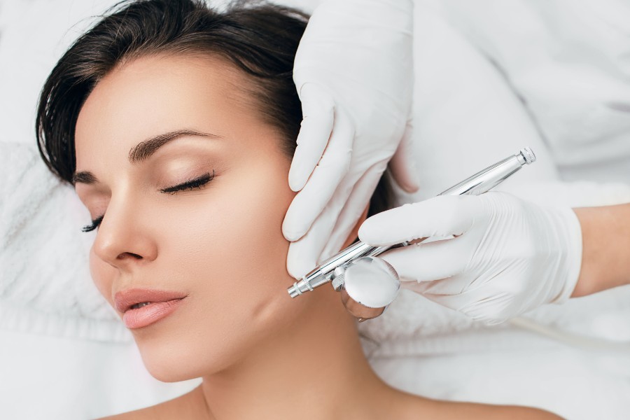 Sẹo mụn: Phân loại và cách trị sẹo mụn giúp da láng mịn 10 cach tri mun seo