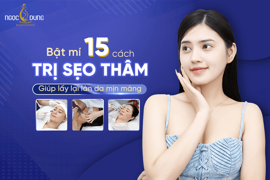 Cách trị sẹo thâm hiệu quả nhanh chóng giúp làn da trắng sáng, đều màu
