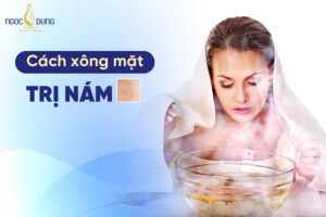 Hướng dẫn cách xông mặt trị nám bằng nguyên liệu tự nhiên