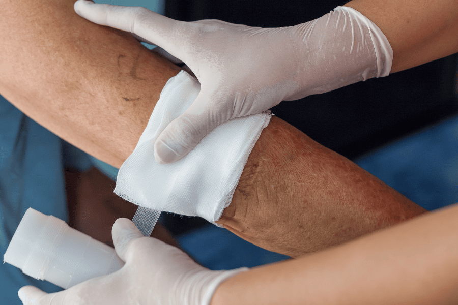 Cần vệ sinh vết thương cẩn thận để tránh nhiễm trùng và hình thành sẹo lồi