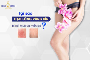 cạo lông vùng kín bị nổi mụn