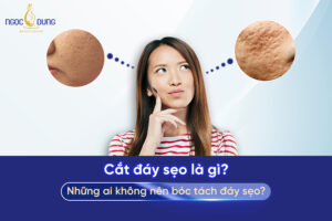 Cắt đáy sẹo