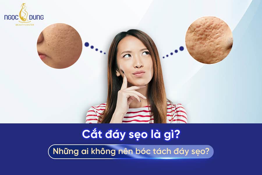 Cắt đáy sẹo là gì? Phương pháp này có hiệu quả không?