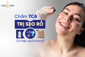 chấm tca trị sẹo rỗ