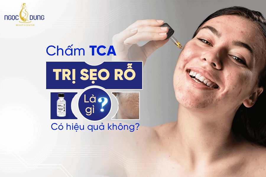 Chấm TCA trị sẹo rỗ là gì? Có hiệu quả không?
