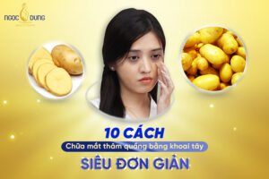 chữa mắt thâm quầng bằng khoai tây