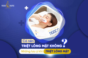 Có nên triệt lông mặt không? Những lưu ý khi triệt lông mặt. Tham khảo ngay!