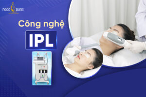 Công nghệ IPL có tốt không?