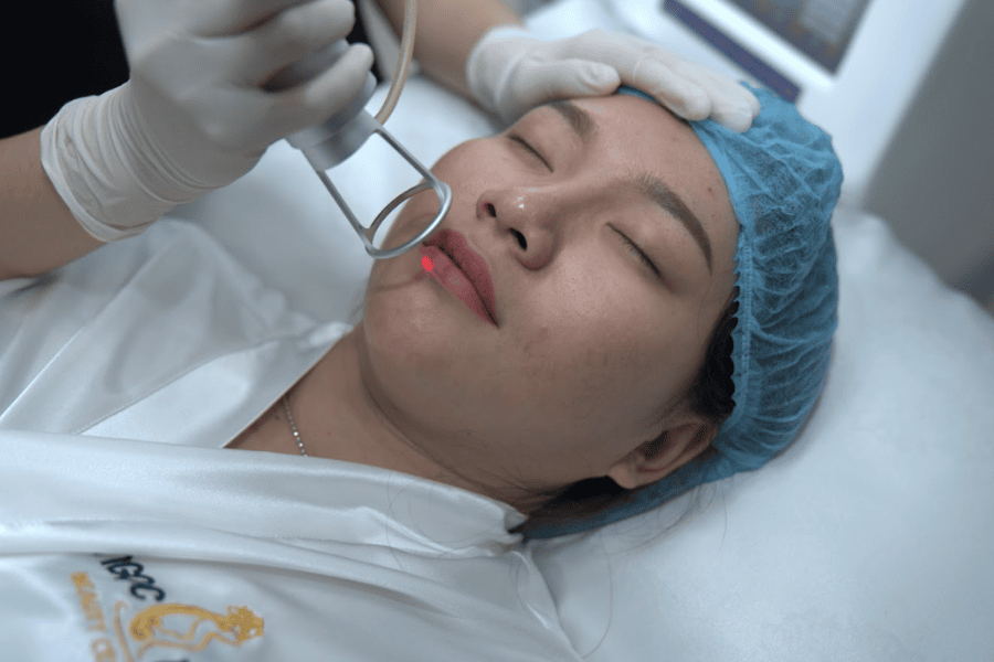 Công nghệ sử dụng sẽ ảnh hưởng lớn tới mức khử thâm môi