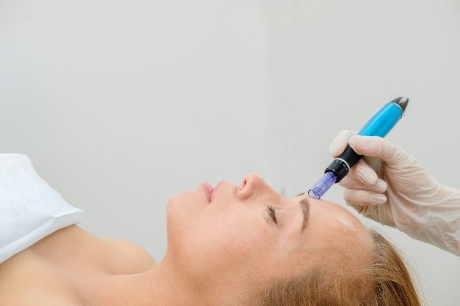 Độ hiệu quả của lăn kim còn phụ thuộc vào tình trạng da hiện tại