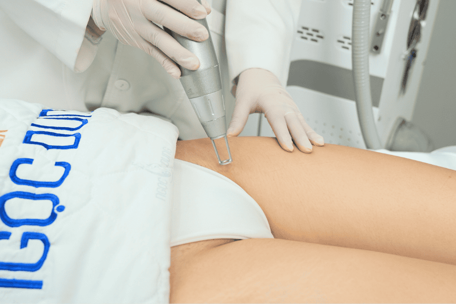 Top các công nghệ làm hồng vùng kín hiện đại 2026 4 Fractional CO₂ phù hợp với những trường hợp thâm lâu năm, thâm do lão hóa,...