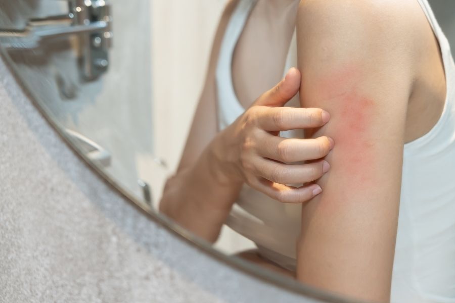 Các lưu ý khi triệt lông: Bí kíp chăm sóc da cực chuẩn 4 Không nên triệt lông khi da đang nhạy cảm và kích ứng