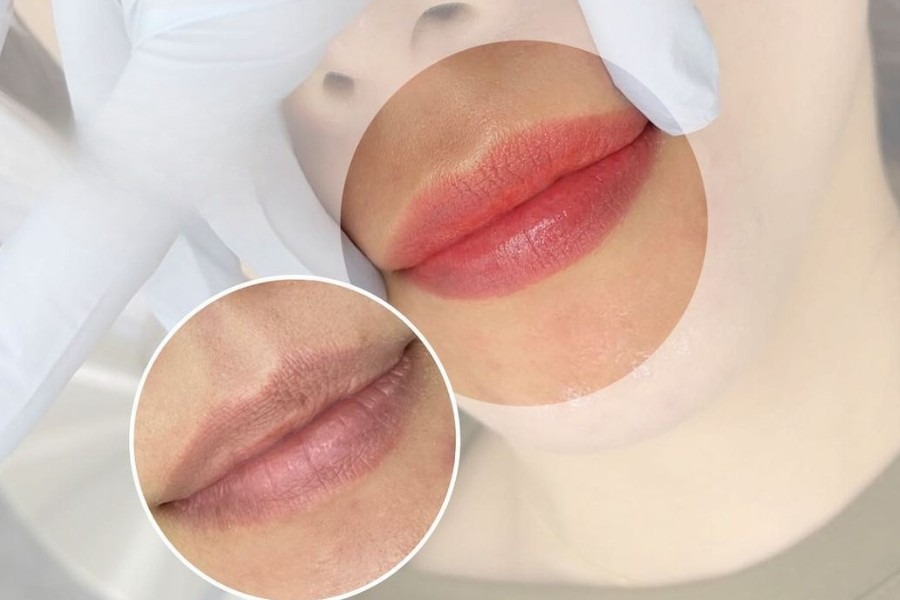 Lấy lại sự tự tin với đôi môi hồng hào, tươi tắn và đầy sức sống