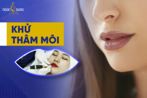 Khử thâm môi là gì? Có nên khử thâm môi không?