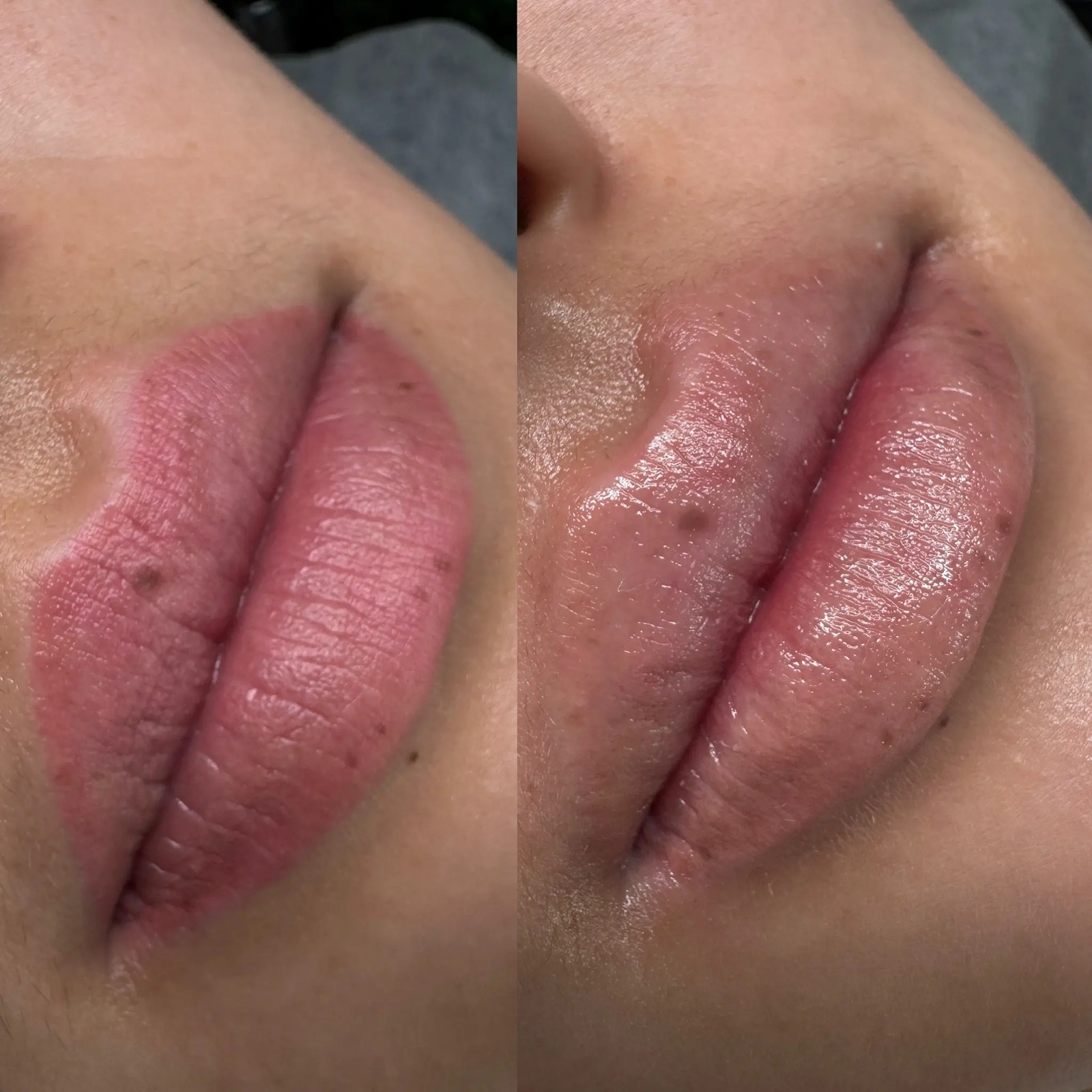 Khử thâm môi nam sẽ giúp loại bỏ các khuyết điểm giúp môi sáng hồng hơn