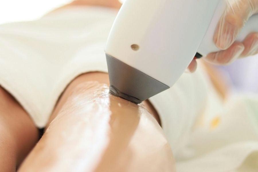 Sau khi triệt lông nên kiêng gì để đạt hiệu quả tối đa? 3 Lợi ích của việc kiêng khem sau khi triệt lông