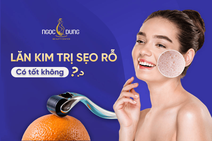 Lăn kim trị sẹo rỗ là gì? Có an toàn và hiệu quả không? 2 Lăn kim trị sẹo rỗ là gì? Có đem lại hiệu quả cao không?