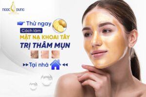mặt nạ khoai tây trị thâm mụn