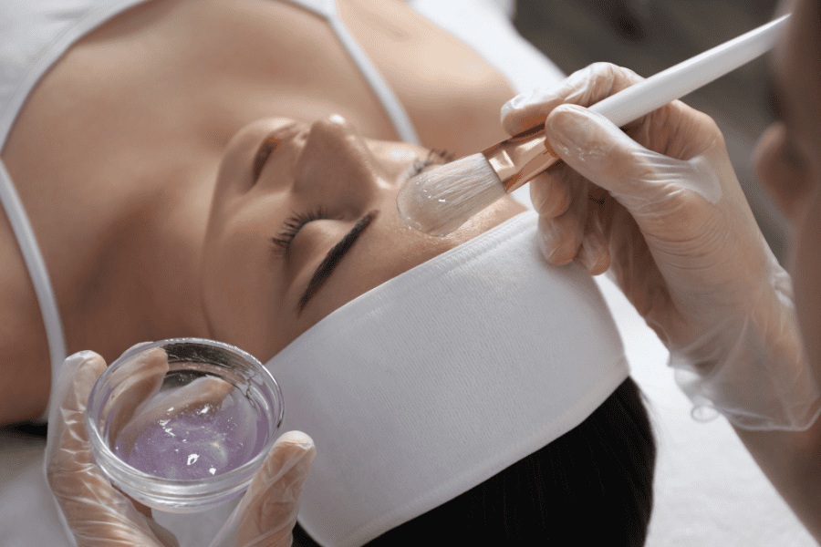 Mỗi loại sẹo sẽ được điều trị bằng TCA có nồng độ khác nhau