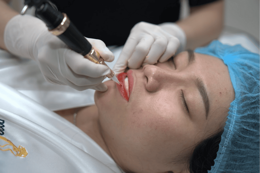 Mức độ thâm môi sẽ ảnh hưởng rất lớn đến mức trị khử thâm 