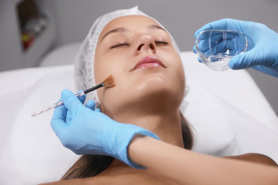 Lột da hóa học giúp tái tạo làn da căng mịn, mờ sẹo thâm Lột da hóa học giúp tái tạo làn da căng mịn, mờ sẹo thâm