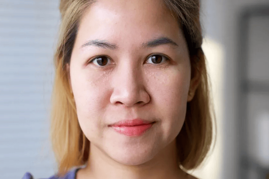 Mụn thịt không thể tự hết mà còn tăng số lượng nếu để lâu trên da