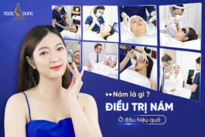 Đâu là nguyên nhân bị nám da mặt? Nám thường xuất hiện ở độ tuổi nào?