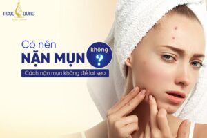 Nặn mụn có tốt không? Có nên nặn mụn? Cách nặn mụn an toàn