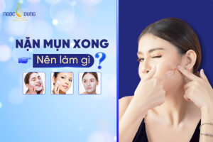 Nặn mụn xong nên làm gì để không bị thâm và sẹo?